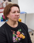 Аку тейпы BB ACU TAPE™ бежевый 